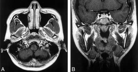 Fig 2.