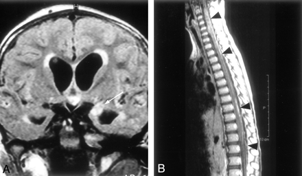 Fig 2.