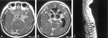 Fig 4.