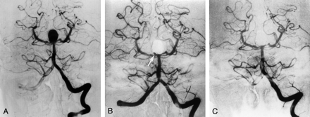 Fig 3.