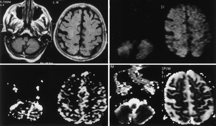 Fig 2.