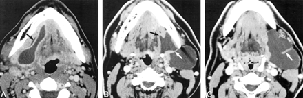 Fig 2.