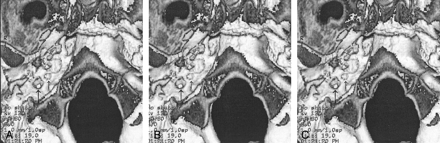 Fig 5.
