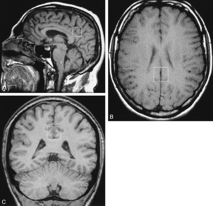 Fig 1.