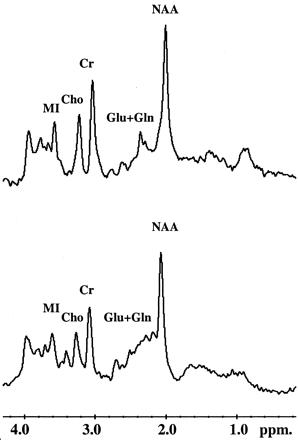Fig 2.
