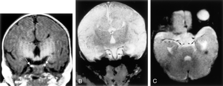 Fig 3.