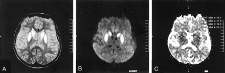 Fig 1.