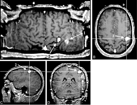 Fig 5.