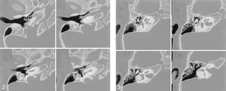 Fig 3.