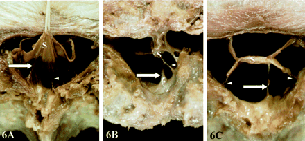 Fig 6.