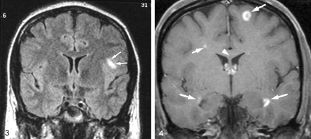Fig 4.