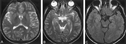 Fig 2.