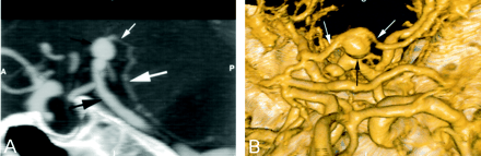 Fig 2.