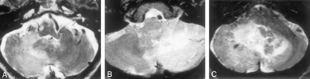 Fig 2.
