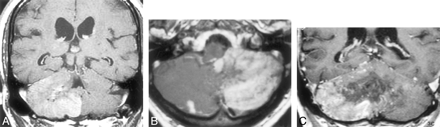 Fig 3.