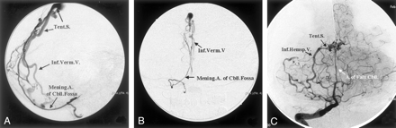 Fig 4.