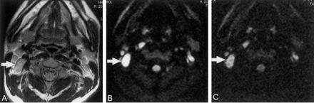 Fig 4.