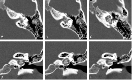 Fig 3.