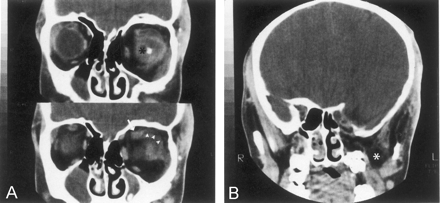 Fig 2.