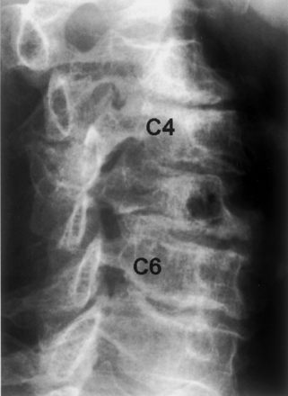 Fig 6.