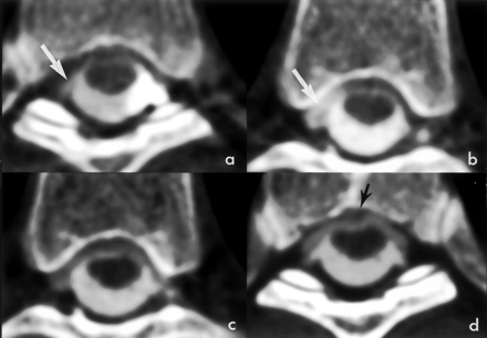 Fig 2.