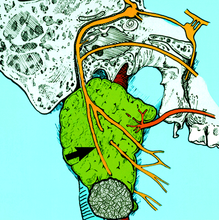 Fig 1.