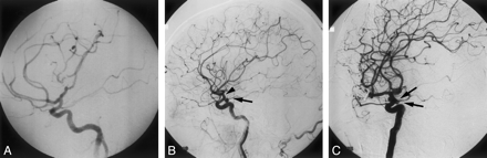 Fig 1.