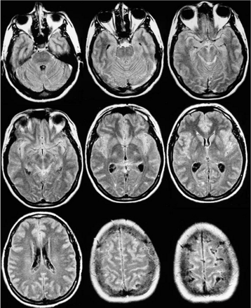Fig 2.