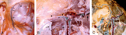 Fig 3.
