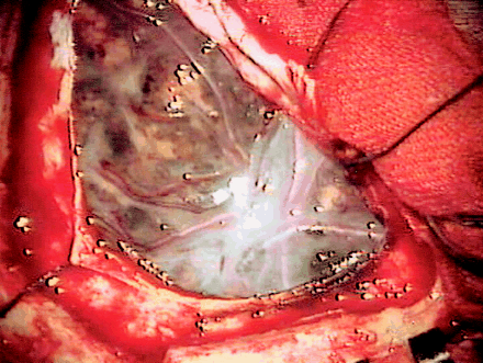 Fig 3.