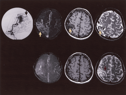 Fig 4.