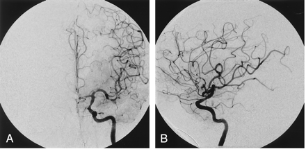 Fig 4.