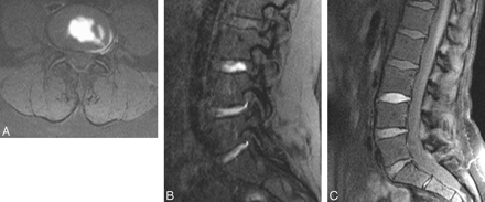 Fig 2.