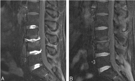 Fig 3.