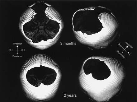 Fig 3.