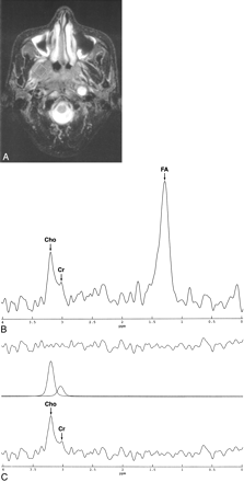 Fig 1.
