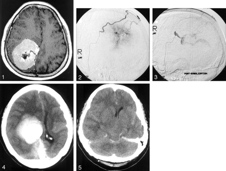 Fig 4.