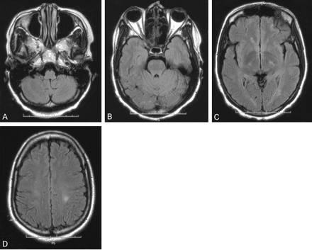 Fig 1.