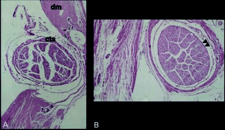 Fig 4.