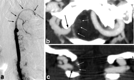 Fig 3.