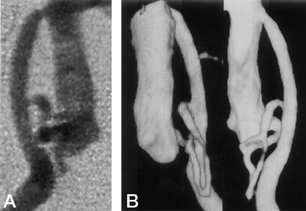 Fig 4.