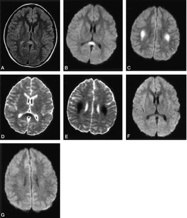 Fig 2.