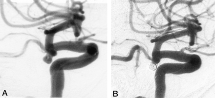 Fig 3.
