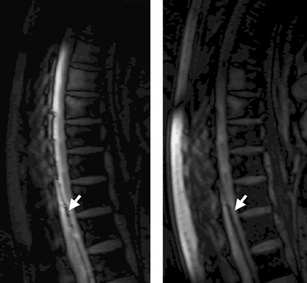 Fig 3.