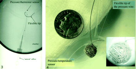 Fig 4.