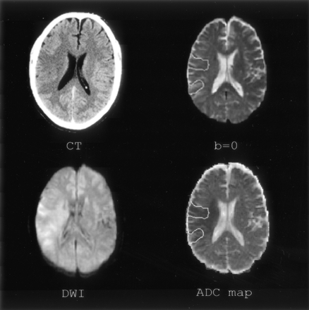 Fig 2.