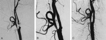Fig 1.