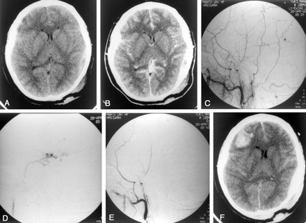 Fig 3.