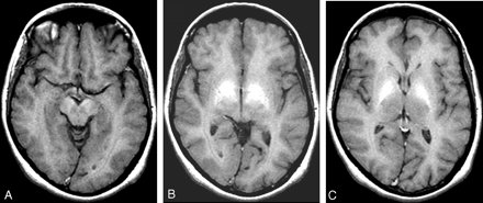 Fig 1.