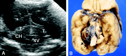 Fig 15.